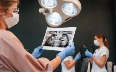 Waarom maakt een tandarts röntgenfoto’s?