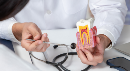 Wortelkanaalbehandeling